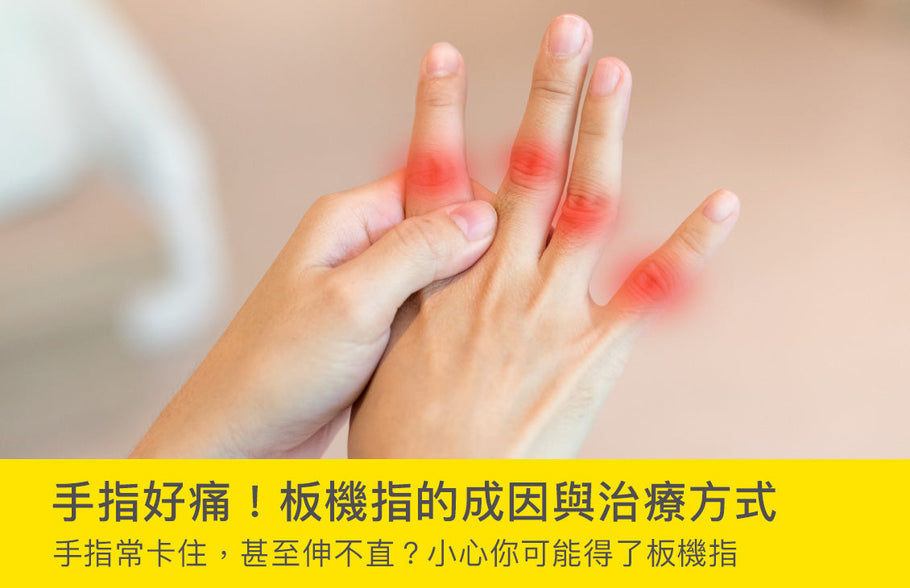 手指好痛！板機指的成因與治療方式