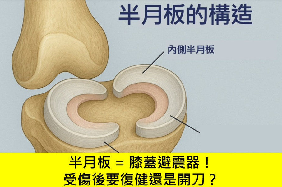 半月板 = 膝蓋避震器！受傷後要復健還是開刀？